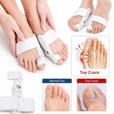 Pain Relief Bunion Toe Corrector & Separator